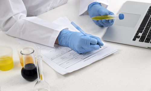 Exame toxicológico: quem precisa fazer e quando deve ser feito?